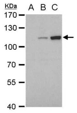Dengue Virus NS5 Antibody (GT361), Novus Biologicals 100 &mu;g | Buy Online | Novus Biologicals | Fisher Scientific
