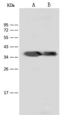 Dengue Virus NS5 Antibody - (methyltransferase domain), Novus Biologicals