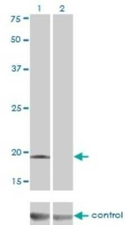 Deoxycytidylate deaminase Antibody (4B9), Novus Biologicals 0.1 mg | Buy Online | Novus Biologicals | Fisher Scientific