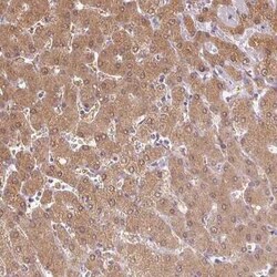 Deoxyguanosine kinase Antibody, Novus Biologicals 25 &mu;L, Unconjugated:Antibodies,