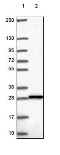 Deoxyguanosine kinase Antibody, Novus Biologicals 25 &mu;L, Unconjugated:Antibodies,