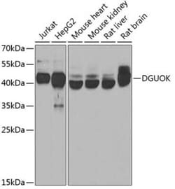 Deoxyguanosine kinase Antibody - BSA Free, Novus Biologicals:Antibodies:Primary
