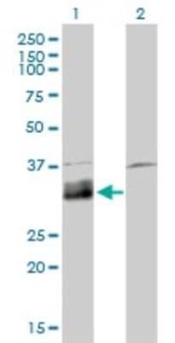 Deoxyribonuclease I like 1 Antibody (4E8), Novus Biologicals 0.1 mg | Buy Online | Novus Biologicals | Fisher Scientific