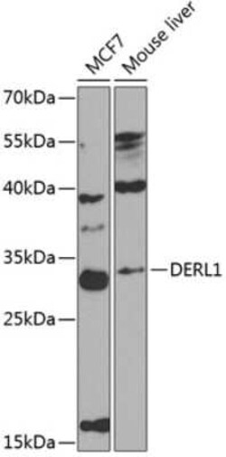 Derlin 1 Antibody - BSA Free, Novus Biologicals:Antibodies:Primary Antibodies