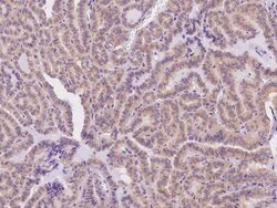 Derlin-2 Antibody, Novus Biologicals 100 &mu;g, Unconjugated:Antibodies,