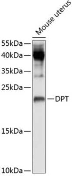 Dermatopontin Antibody - BSA Free, Novus Biologicals:Antibodies:Primary
