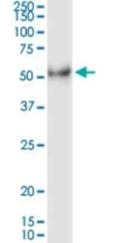 Desert Hedgehog/Dhh Antibody (2D5), Novus Biologicals 0.1 mg, Unconjugated:Antibodies,