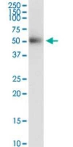 Desert Hedgehog/Dhh Antibody (3E6), Novus Biologicals 0.1 mg | Buy Online | Novus Biologicals | Fisher Scientific