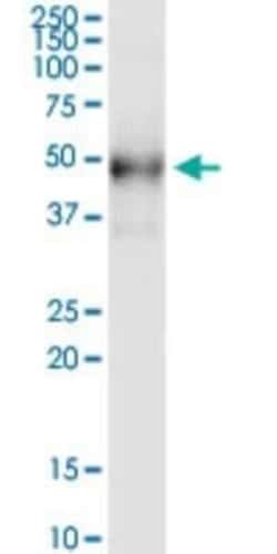 Desert Hedgehog/Dhh Antibody (4F10), Novus Biologicals 0.1 mg | Buy Online | Novus Biologicals | Fisher Scientific