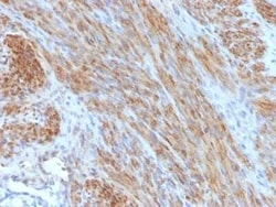 Desmin Antibody (DES/1711), Novus Biologicals 20&mu;g; Unlabeled:Antibodies,