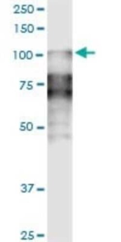 Desmocollin-2 Antibody (1F2), Novus Biologicals 0.1 mg | Buy Online | Novus Biologicals | Fisher Scientific