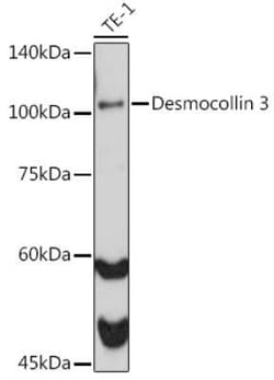 Desmocollin-3 Rabbit anti-Human, Clone: 7H1O6, Novus Biologicals:Antibodies:Primary