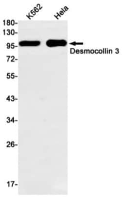 Desmocollin-3 Antibody (S06-4G2), Novus Biologicals 100 &mu;g; Unconjugated:Antibodies,