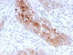 Desmoglein-1 Antibody (32-2B) - Azide and BSA Free, Novus Biologicals 100 &mu;g | Buy Online | Novus Biologicals | Fisher Scientific