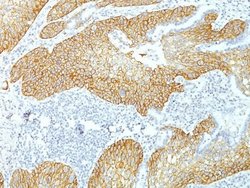 Desmoglein-3 Antibody (DSG3/1535) - Azide and BSA Free, Novus Biologicals 100 &mu;g | Buy Online | Novus Biologicals | Fisher Scientific