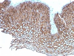 Desmoglein-3 Antibody (DSG3/2837) - Azide and BSA Free, Novus Biologicals