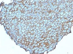 Desmoglein-3 Antibody (DSG3/2838) - Azide and BSA Free, Novus Biologicals
