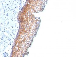 Desmoglein-3 Antibody (DSG3/2838) - Azide and BSA Free, Novus Biologicals