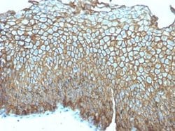 Desmoglein-3 Mouse anti-Human, Clone: DSG3/2839, Novus Biologicals:Antibodies:Primary