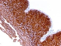 Desmoglein-3 Mouse anti-Human, Clone: DSG3/2839, Novus Biologicals:Antibodies:Primary