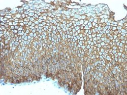 Desmoglein-3 Antibody (DSG3/2839) - Azide and BSA Free, Novus Biologicals