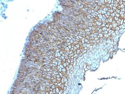 Desmoglein-3 Antibody (DSG3/2839) - Azide and BSA Free, Novus Biologicals
