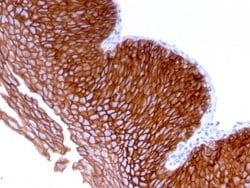 Desmoglein-3 Antibody (DSG3/2839) - Azide and BSA Free, Novus Biologicals