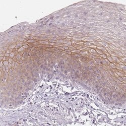 Desmoglein-3 Antibody, Novus Biologicals 25 &mu;L | Buy Online | Novus Biologicals | Fisher Scientific