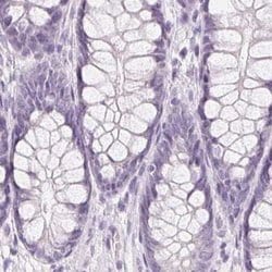 Desmoglein-3 Antibody, Novus Biologicals 25 &mu;L | Buy Online | Novus Biologicals | Fisher Scientific