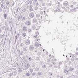 Desmoglein-3 Antibody, Novus Biologicals 25 &mu;L | Buy Online | Novus Biologicals | Fisher Scientific