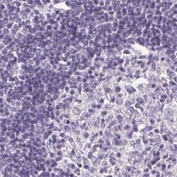 Desmoglein-3 Antibody, Novus Biologicals 25 &mu;L:Antibodies, Polyclonal