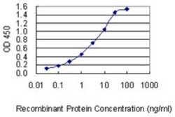 Desmoglein-4 Antibody (6E7), Novus Biologicals 0.1 mg | Buy Online | Novus Biologicals | Fisher Scientific
