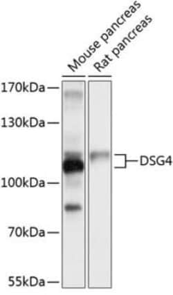 Desmoglein-4 Antibody - BSA Free, Novus Biologicals 0.1 mL, Unconjugated:Antibodies,