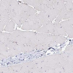 Desmoplakin Antibody, Novus Biologicals:Antibodies:Primary Antibodies