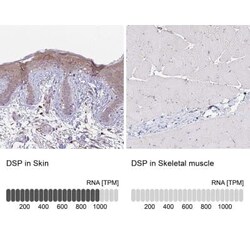 Desmoplakin Antibody, Novus Biologicals:Antibodies:Primary Antibodies