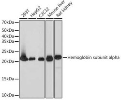 Dihydrofolate Reductase/DHFR Rabbit anti-Human, Mouse, Rat, Clone: 7N3X4,