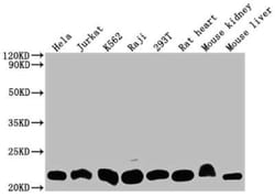 Dihydrofolate Reductase/DHFR Antibody (9B2), Novus Biologicals 100 &mu;g;