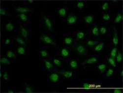 Dihydrofolate Reductase/DHFR Antibody (2B10), Novus Biologicals 0.1 mg,
