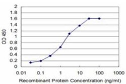 Dihydrofolate Reductase/DHFR Antibody (2B10), Novus Biologicals 0.1 mg,