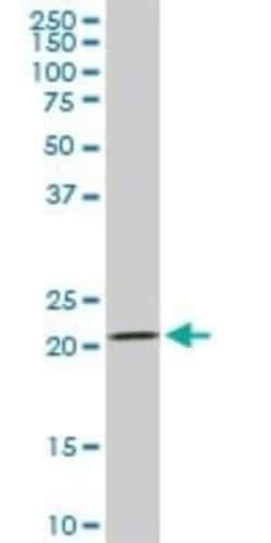 Dihydrofolate Reductase/DHFR Antibody (2B10), Novus Biologicals 0.1 mg,