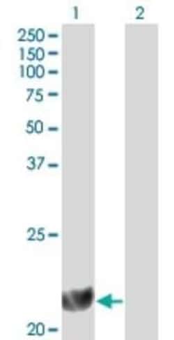 Dihydrofolate Reductase/DHFR Antibody (2B10), Novus Biologicals 0.1 mg,