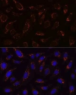 Dihydrolipoamide Dehydrogenase/DLD Rabbit anti-Human, Mouse, Rat, Clone: 3J2O9, Novus Biologicals 100 &mu;g | Buy Online | Novus Biologicals | Fisher Scientific