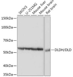 Dihydrolipoamide Dehydrogenase/DLD Rabbit anti-Human, Mouse, Rat, Clone: 3J2O9, Novus Biologicals 100 &mu;g | Buy Online | Novus Biologicals | Fisher Scientific
