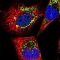 Dihydrolipoamide Dehydrogenase/DLD Antibody, Novus Biologicals 25 &mu;L | Buy Online | Novus Biologicals | Fisher Scientific