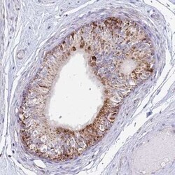 Dihydrolipoamide Dehydrogenase/DLD Antibody, Novus Biologicals 25 &mu;L | Buy Online | Novus Biologicals | Fisher Scientific