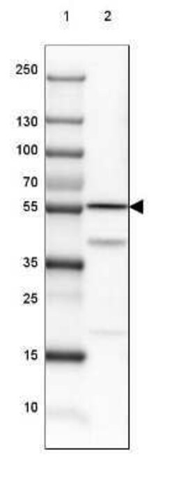 Dihydrolipoamide Dehydrogenase/DLD Antibody, Novus Biologicals 25 &mu;L | Buy Online | Novus Biologicals | Fisher Scientific