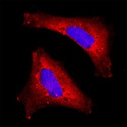 Human Dihydrolipoamide Dehydrogenase/DLD Antibody, R D Systems:Antibodies:Primary