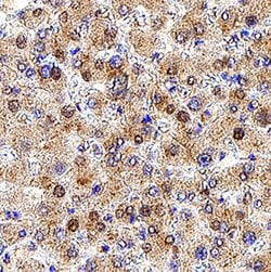 Human Dihydrolipoamide Dehydrogenase/DLD Antibody, R D Systems:Antibodies:Primary