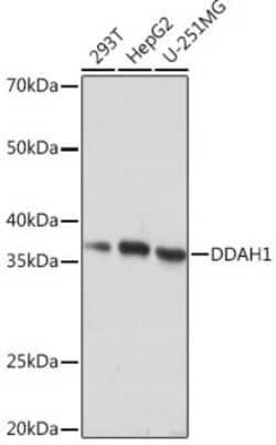 Dimethylarginine Dimethylaminohydrolase 1/DDAH1 Rabbit anti-Human, Rat,