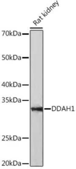 Dimethylarginine Dimethylaminohydrolase 1/DDAH1 Rabbit anti-Human, Rat,